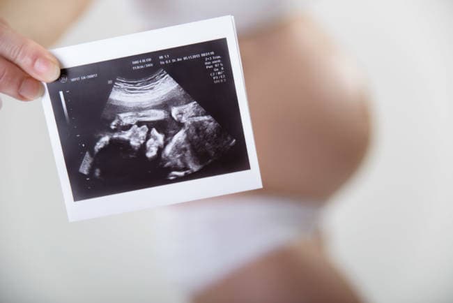 03 Schwangerschaftsfoto